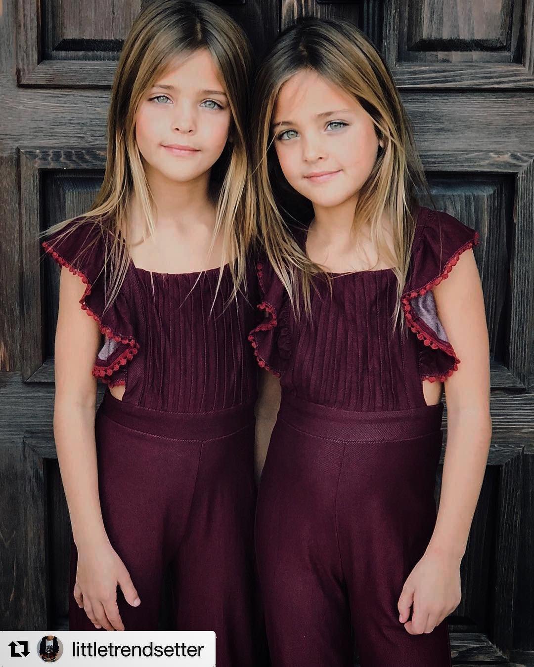 Identical Twins Are Now Being Called The Most Beautiful In The World    Baby 10 