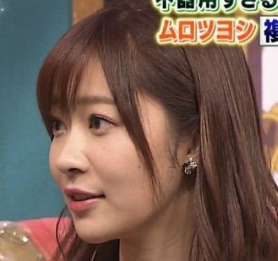 指原莉乃　整形