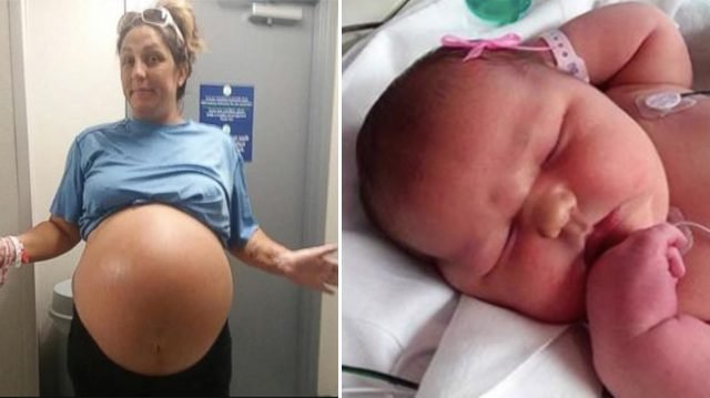 Pregnant mom was nearing due date—but everyone couldn’t believe their eyes on seeing the baby