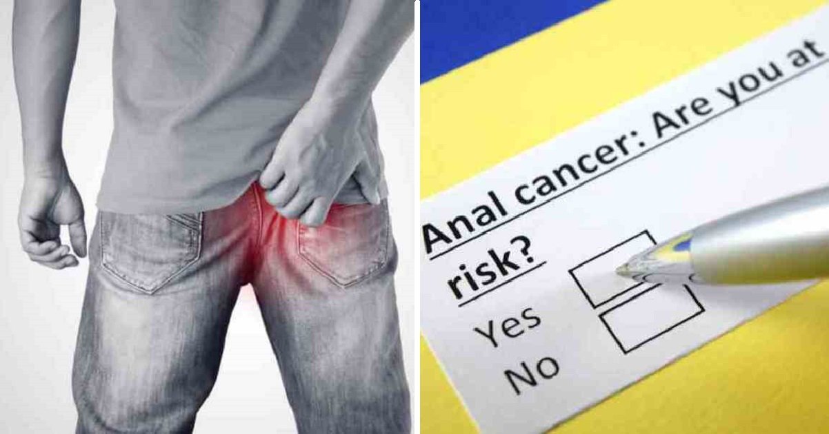 Six Early Anal Cancer Warning Signs That People Are Embarrassed To Talk