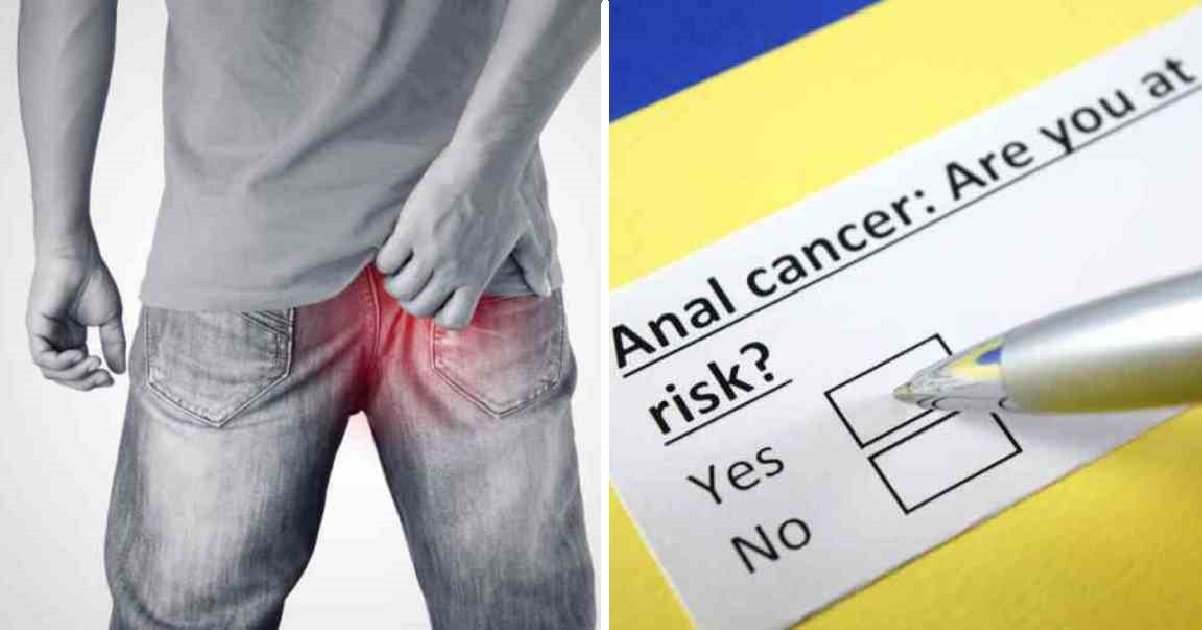 analcancer2 1.jpg?resize=412,232 - Six Early Anal Cancer Warning Signs That People Are Embarrassed To Talk About