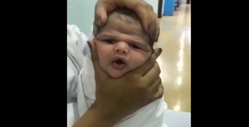 baby 1.png?resize=412,232 - Saudi Nurses Fired For Squashing Newborn Baby's Face