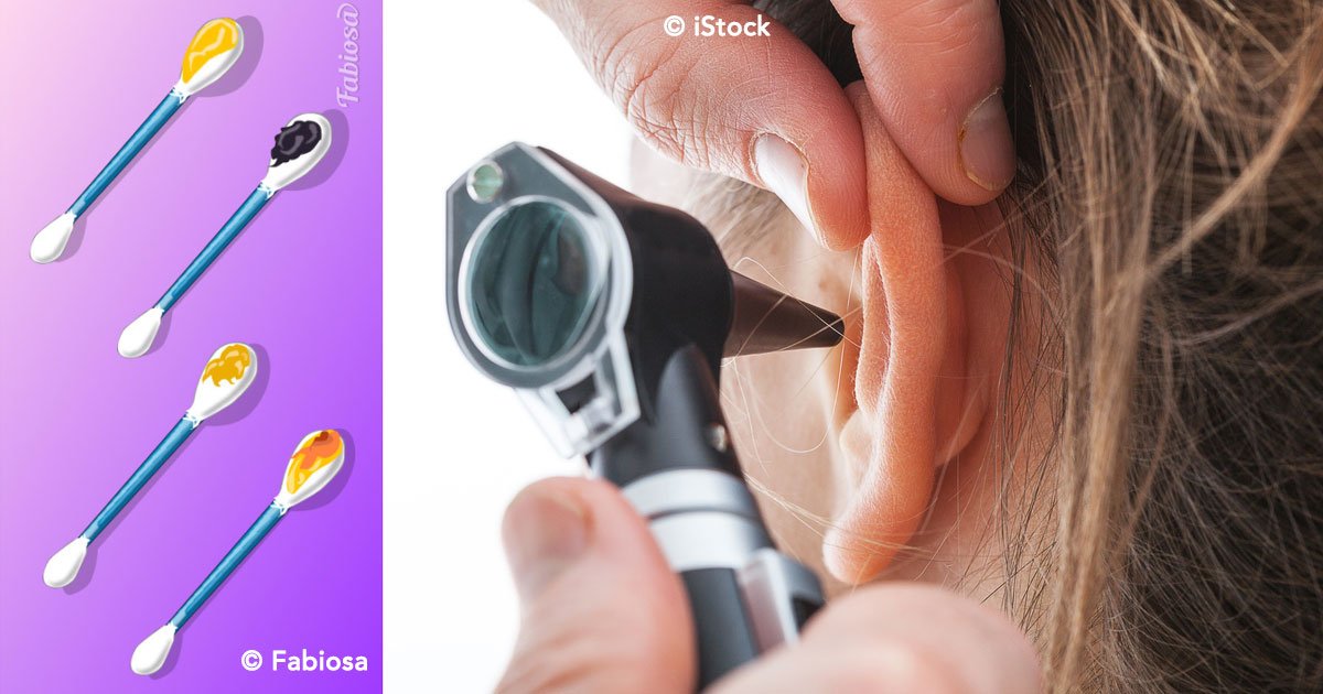 cover 40.jpg?resize=1200,630 - La cera de tus oídos puede revelar datos importantes sobre tu salud