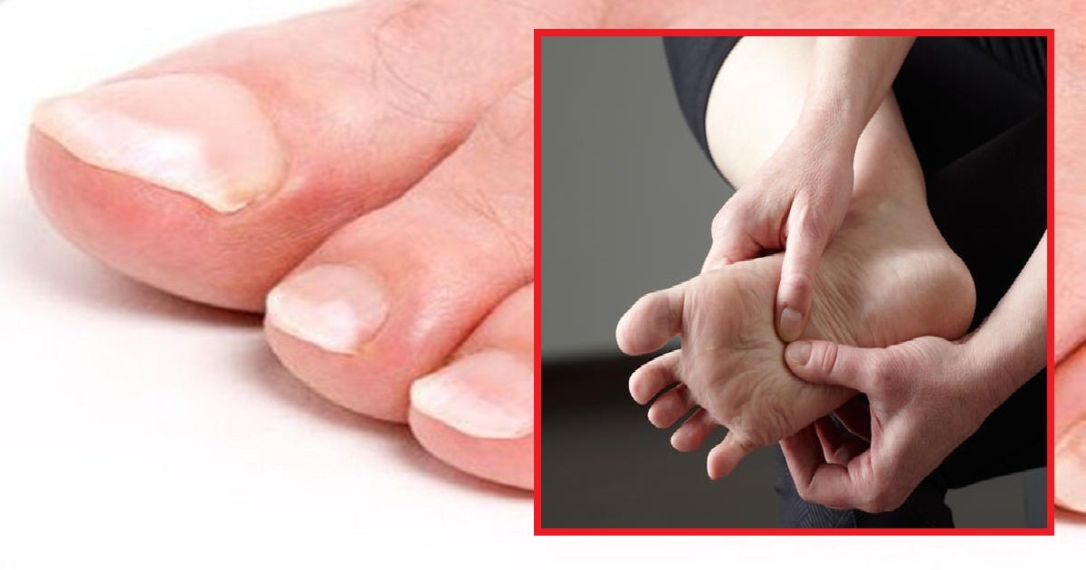 feet3 1.jpg?resize=412,275 - 10 Common Feet Signs That May Indicate Underlying Health Problems