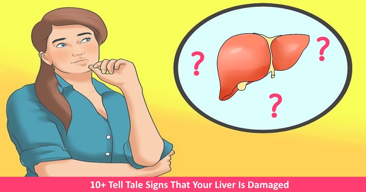 liverdamaged.jpg?resize=412,275 - 10+ Common Signs That May Indicate That Your Liver Is Facing Problems