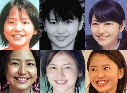 長澤まさみの整形疑惑が話題に デビューと比較すると鼻と目に違和感 Hachibachi 長澤まさみの整形疑惑が話題に デビューと比較すると鼻と目に違和感 Hachibachi