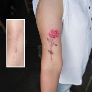 cicatrizes-tatuagem-encobrimento-37-590b1ddb1a2d9__605
