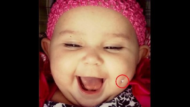 thumb nail baby peerce.jpg?resize=412,232 - Une mère poste la photo de son bébé avec un piercing dans la joue et créer un tollé!