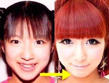 辻希美の昔の画像が別人すぎ 整形疑惑に迫ってみる Hachibachi 辻希美の昔の画像が別人すぎ 整形疑惑に迫ってみる Hachibachi