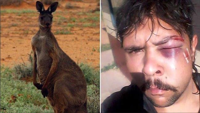 RUSH HOUR: Hunter has jaw broken in kangaroo attack