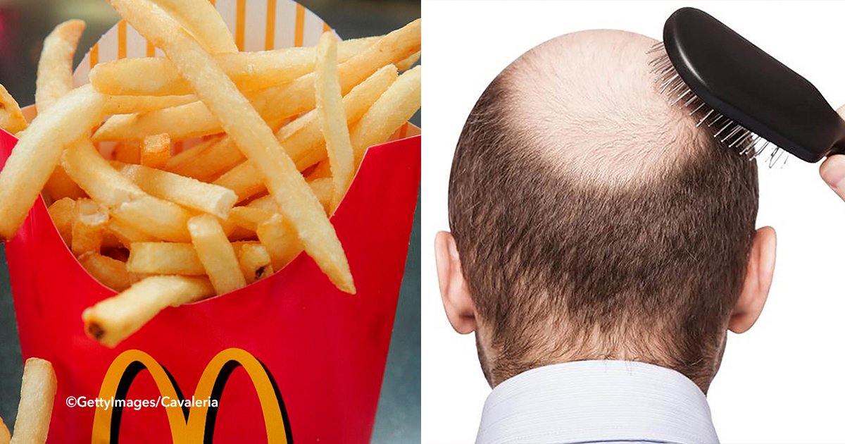 cdscsdcds.png?resize=412,275 - Según un estudio, las papas fritas de McDonald's podrían curar la calvicie debido a una sustancia química.