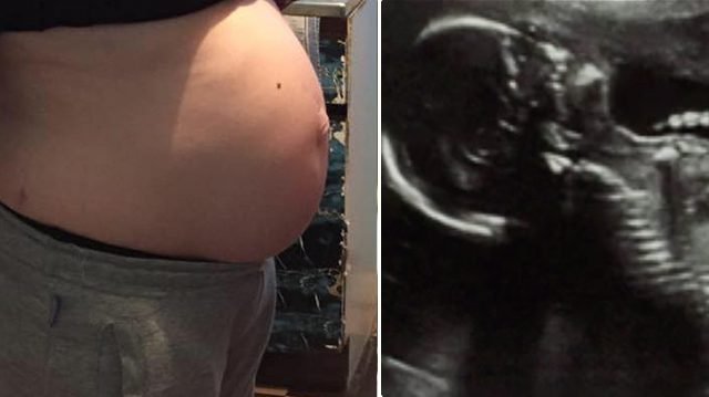 Doctors tell mom unborn baby is dead—but she believes they’re wrong and discharges herself