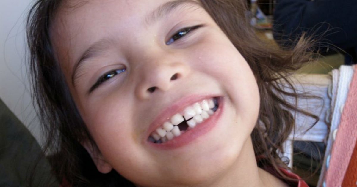 untitled 20.jpg?resize=412,232 - Estudo recente mostra que os dentes de leite têm grandes benefícios médicos