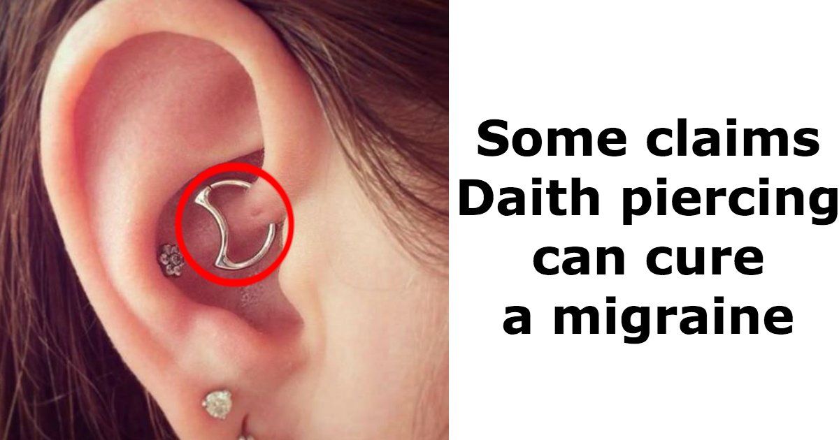 untitled 73.jpg?fit=1024%2C538&ssl=1&strip=all - Piercings Were Used As A Remedy For A Chronic Migraine