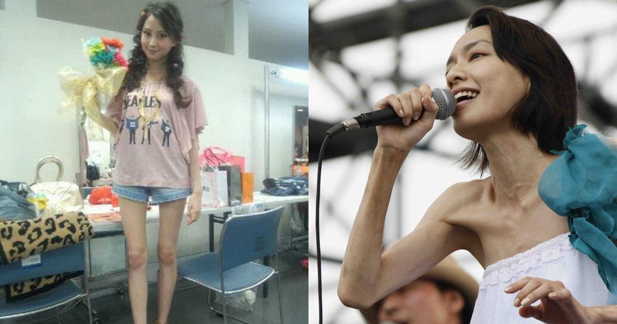yase.jpg?resize=300,169 - ”摂食障害・拒食症”の症状の噂がある芸能人