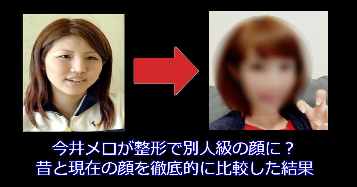 今井メロが整形で別人級の顔に 昔と現在の顔を徹底的に比較した結果 Hachibachi