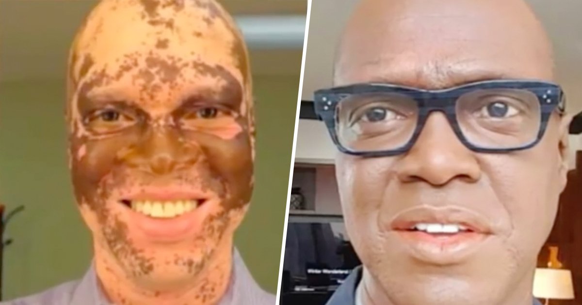 3ec8db8eb84ac 3.jpg?resize=1200,630 - TV Reporter Who Started Turning White Saved His Career By Painting His Face Every Day