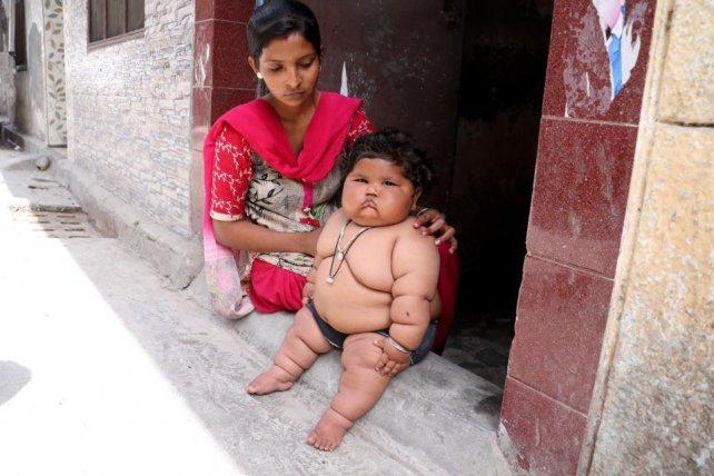 El bebÃ© Michelin: tiene ocho meses y pesa 17 kilos
