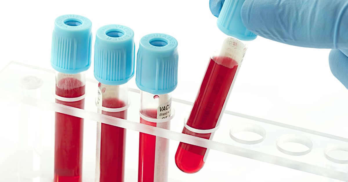 blood.png?resize=412,232 - Exame de sangue pode detectar qualquer tipo de câncer dez anos antes de se manifestar