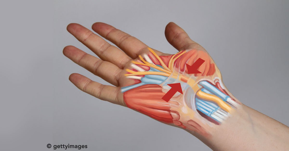 Síndrome Del Túnel Carpiano Causas Síntomas Cómo Prevenirlo Y