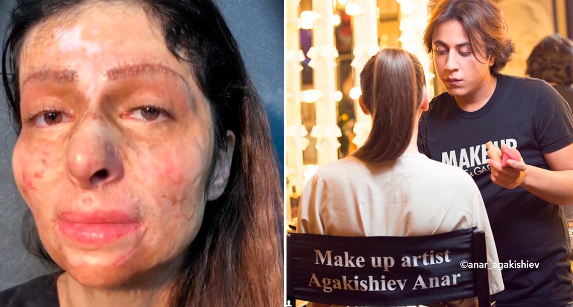 cover 4make.png?resize=412,232 - Este maquillador transforma el rostro quemado de una mujer que sufrió un accidente cuando tenía 11 años