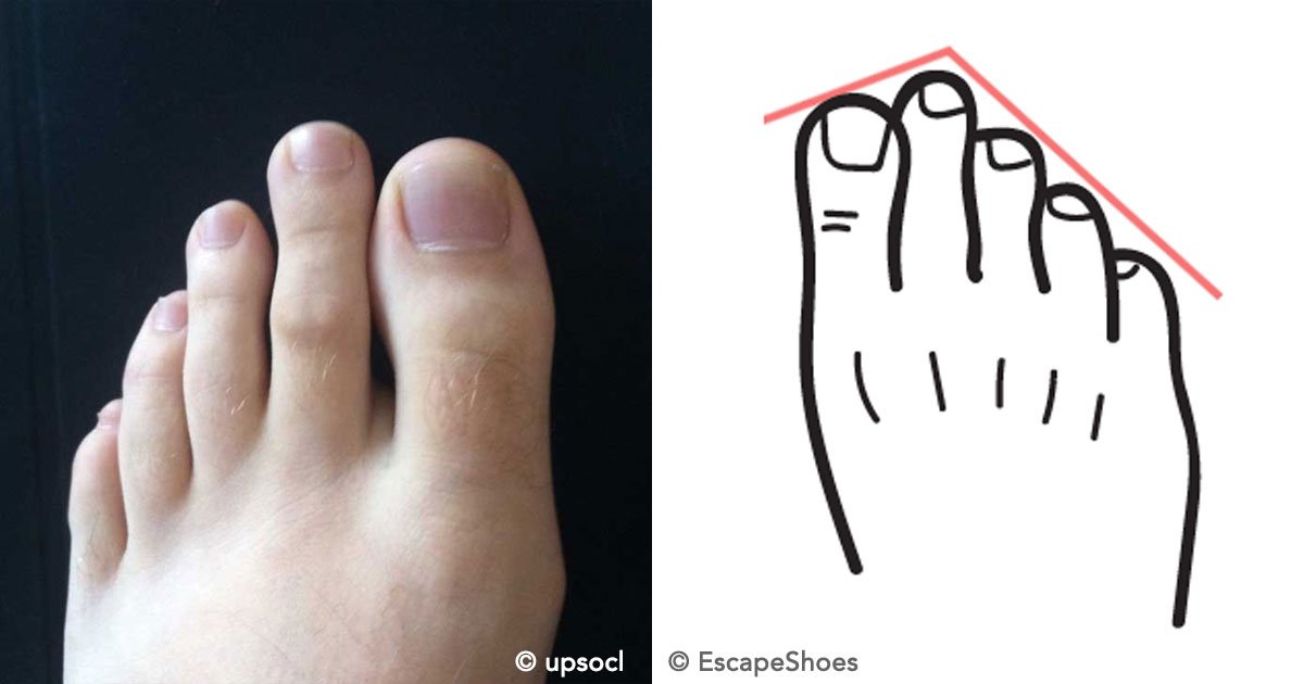 cover 59.jpg?resize=1200,630 - O que significa ter o segundo dedo do pé mais longo que o dedão?