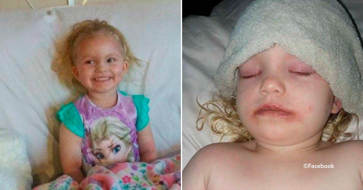 cover22maqnena.jpg?resize=412,232 - Una niña de tres años sufrió una fuerte alergia luego de usar maquillaje "barato"