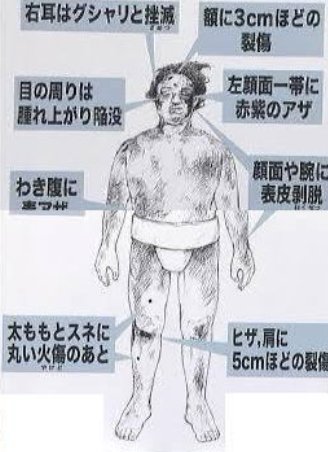 ごめんな 何かが変わると思ったんだけどな 10年前の 時津風部屋暴力事件 から相撲界は何が変わった Hachibachi