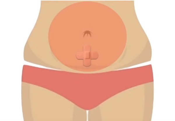 '배꼽에 반창고' 붙이면 발생하는 놀라운 효과 img 5abb37ee015b9 - '배꼽에 반창고' 붙이면 발생하는 놀라운 효과