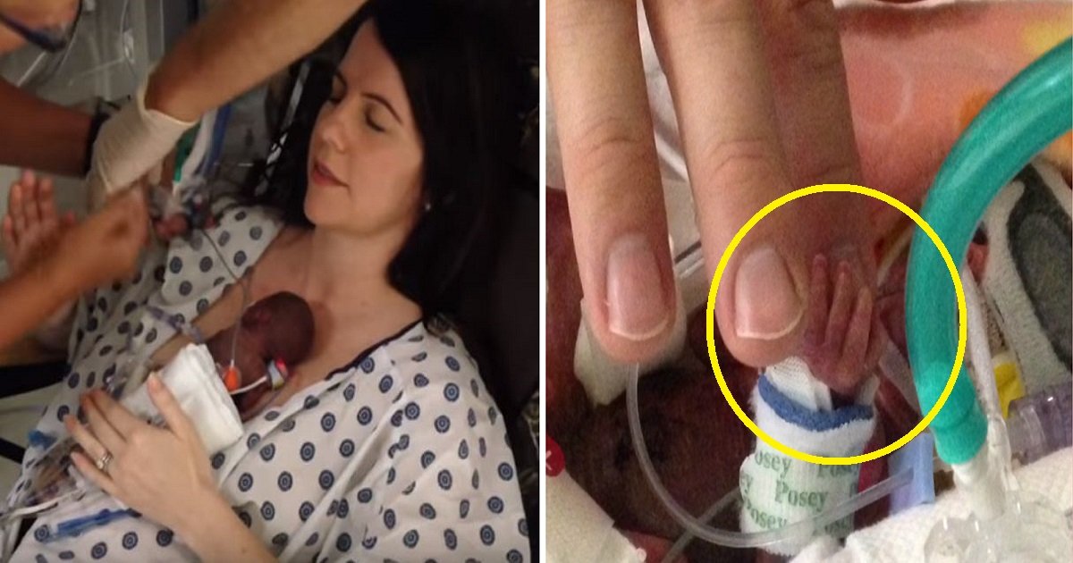 Cette Maman Tient Pour La Premiere Fois Sa Fille Prematuree Nee Seulement Apres 25 Semaines Vonjour