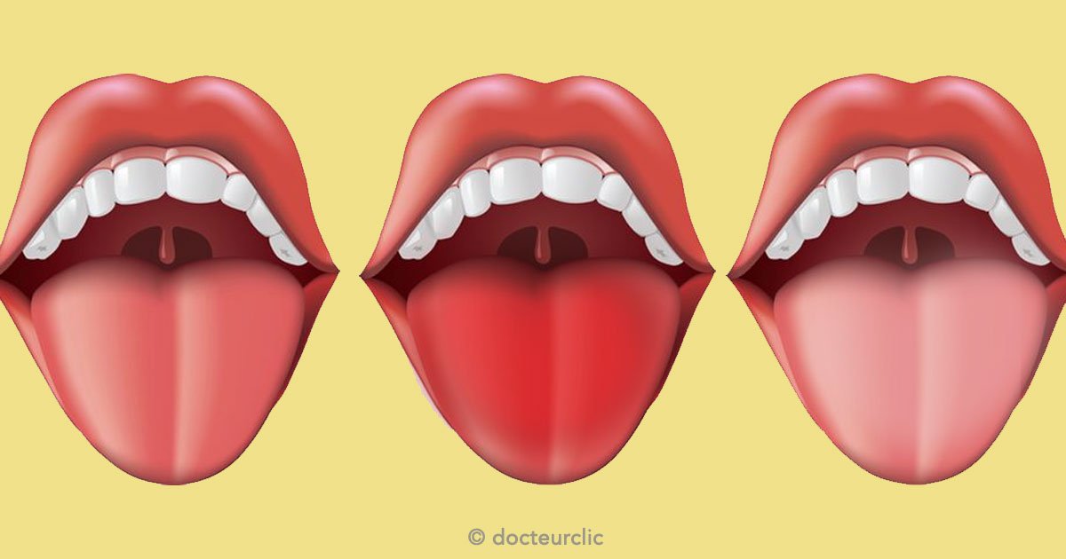 untitled 1 119.jpg?resize=1200,630 - El color de tu lengua puede revelar más de lo que imaginas sobre tu salud