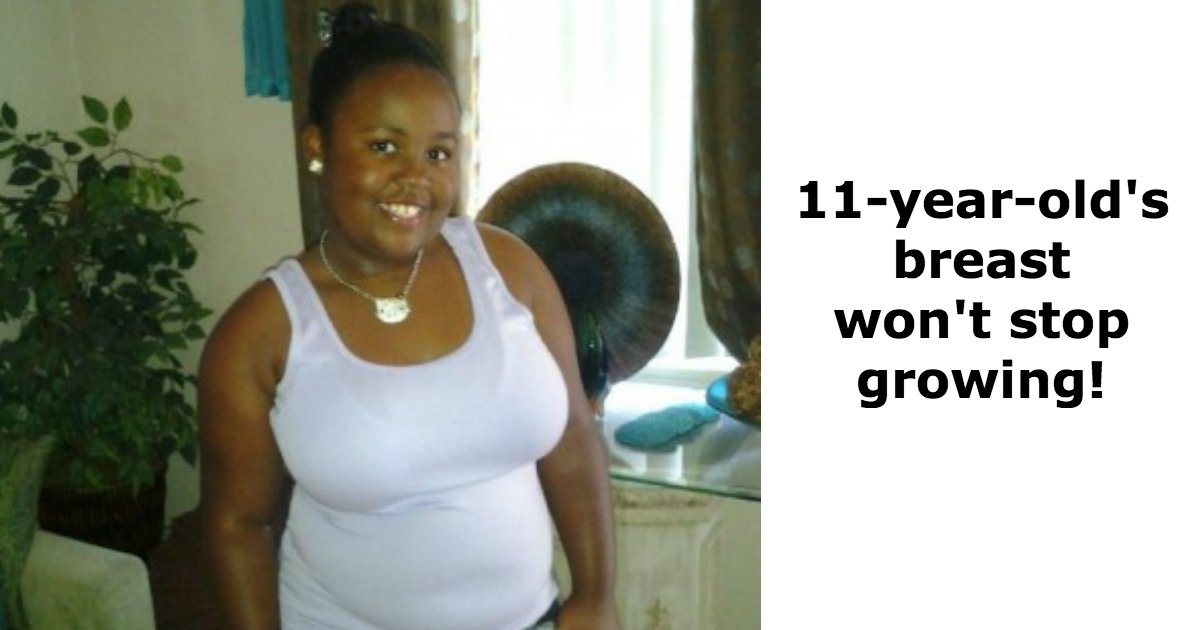 untitled 1 138.jpg?resize=1200,630 - A 9 ans, cette enfant a connu une poussée de sein si forte qu'elle a du opter pour une réduction mammaire.
