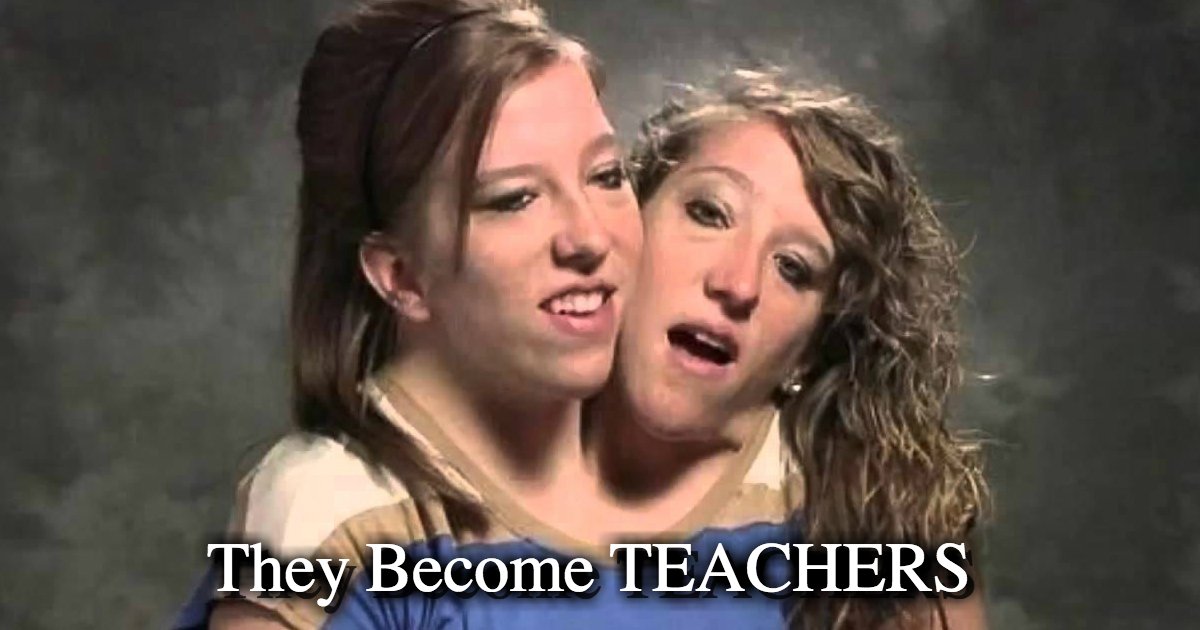 Conjoined Twins Abby And Brittany Became Teachers Small Joys