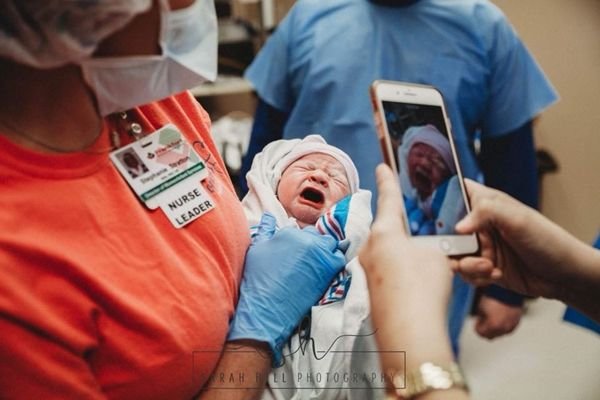 제왕절개 수술 중 직접 아이 꺼낸 산모