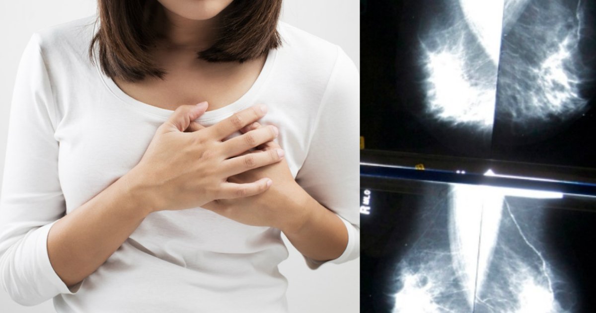 breast cancer treatment.jpg?resize=1200,630 - Des médecins mettent en garde contre le risque cardiaque accru de certains traitements du cancer du sein