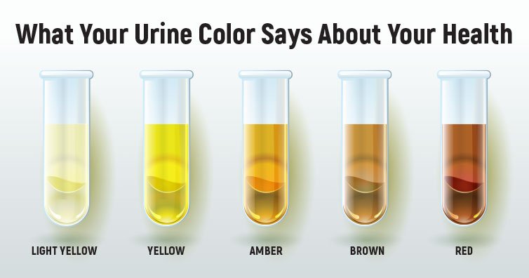 couleur de l'urine-indique-votre-santé-1