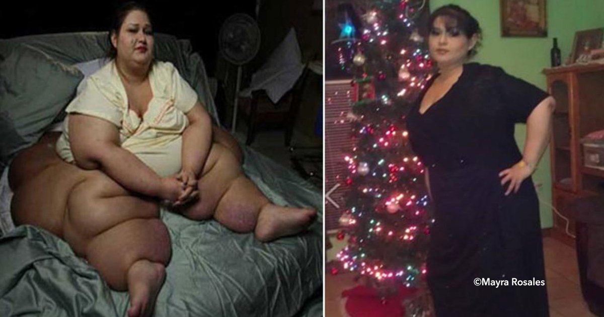 cover22supegord.jpg?resize=1200,630 - Perdió más de 400 kilos gracias a los médicos que le cambiaron la vida. Era la mujer más obesa del mundo