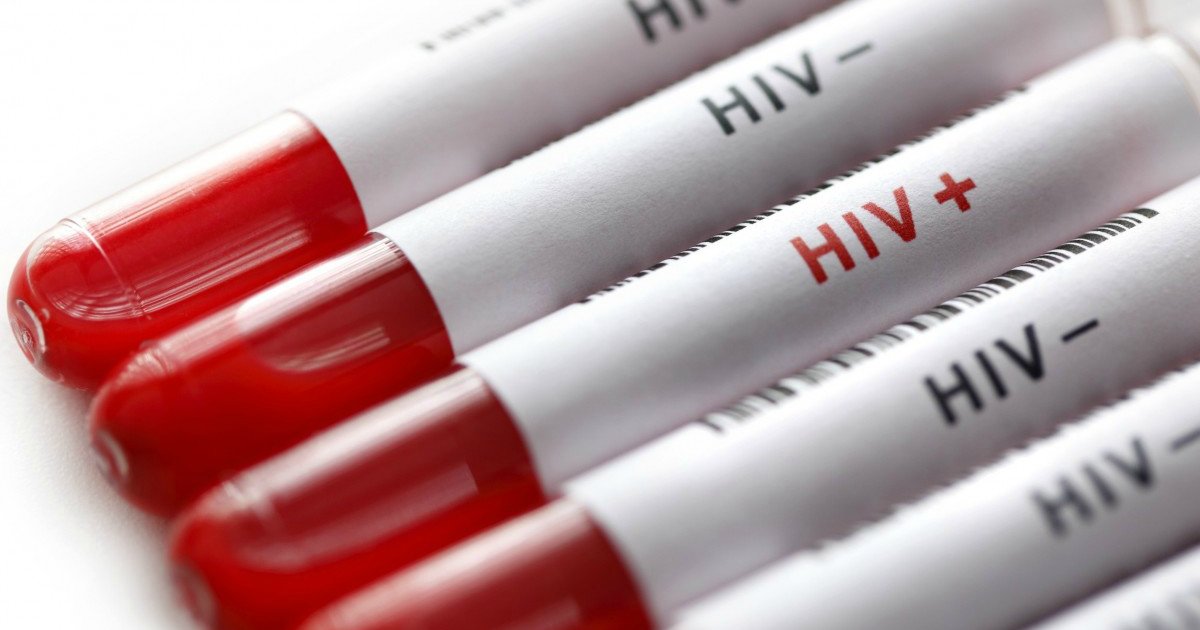 hivthum.png?resize=412,232 - Cura do HIV: pesquisadores brasileiros descobrem uma planta que pode acabar com o vírus