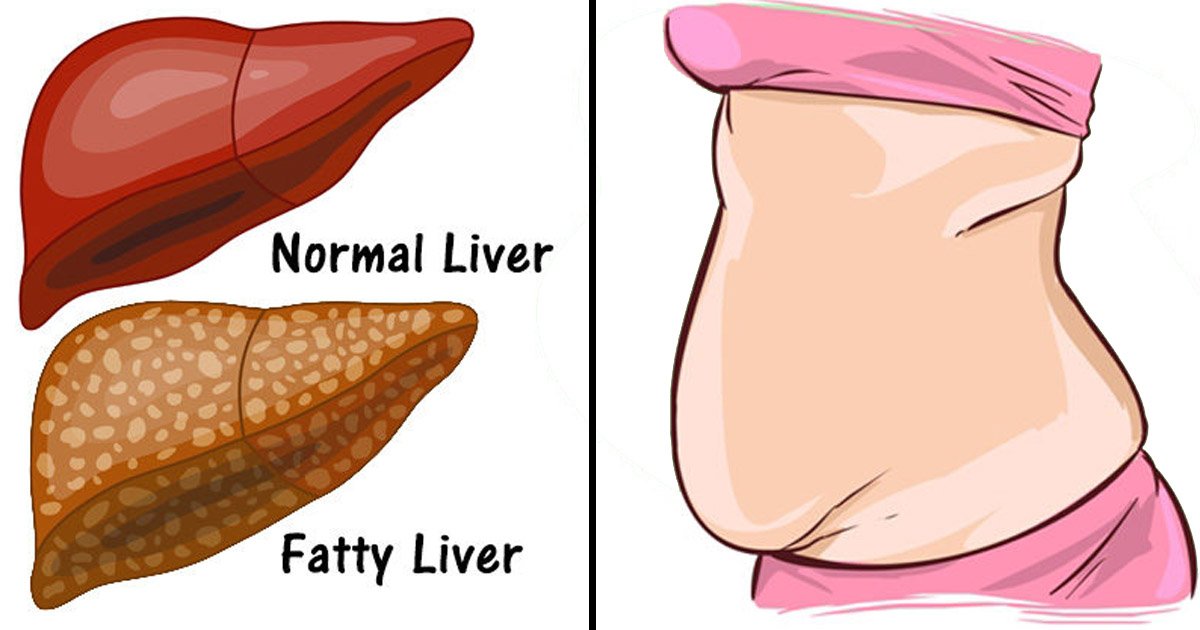 liver.jpg?resize=412,232 - 5 Warning Signs And Symptoms Your Liver Is Already Full Of Toxins