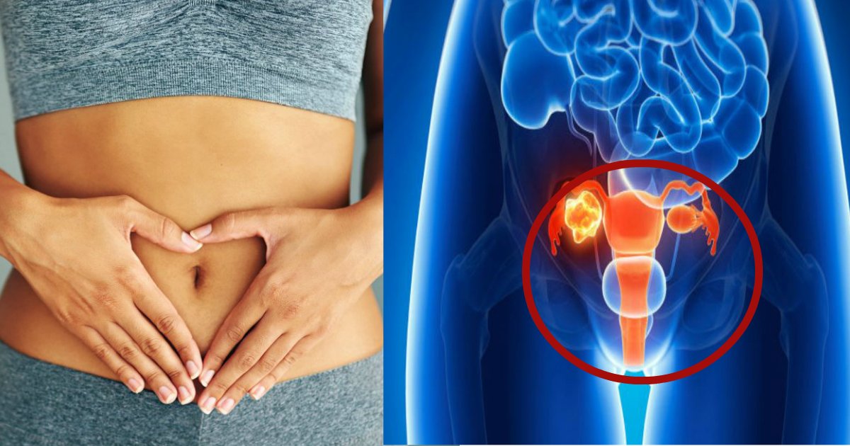 ovarian cancer 1.jpg?resize=1200,630 - Beaucoup de femmes confondent les premiers symptômes du cancer de l'ovaire avec des ballonnements