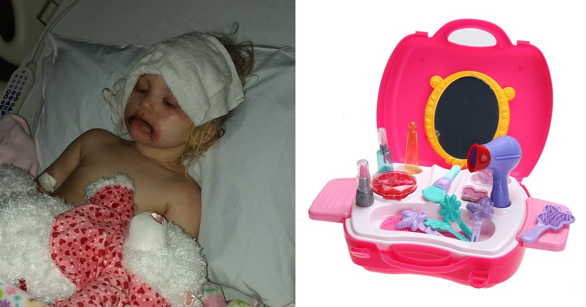 untitled 1 16.jpg?resize=300,169 - Cosméticos de brinquedo causaram reações alérgicas graves nesta menina de 3 anos