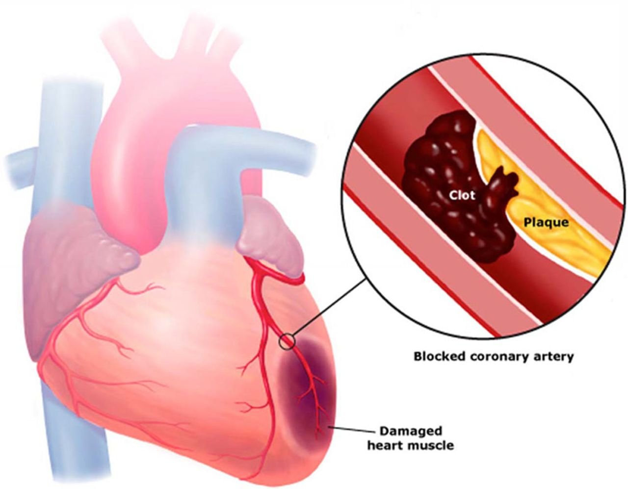 8 Early Warning Signs Of A Blood Clot You Should Never Ignore - Small Joys