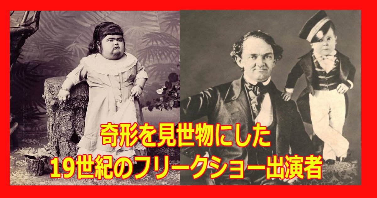 奇形を見世物にした19世紀のフリークショー出演者まとめ Hachibachi