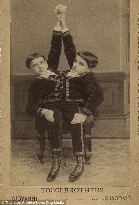 Siamese twins such as the Tocci Brothers were a hit as well