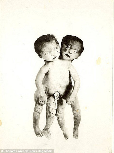 Some of the more disturbing images in the archive feature babies who were stillborn but still included in the shows