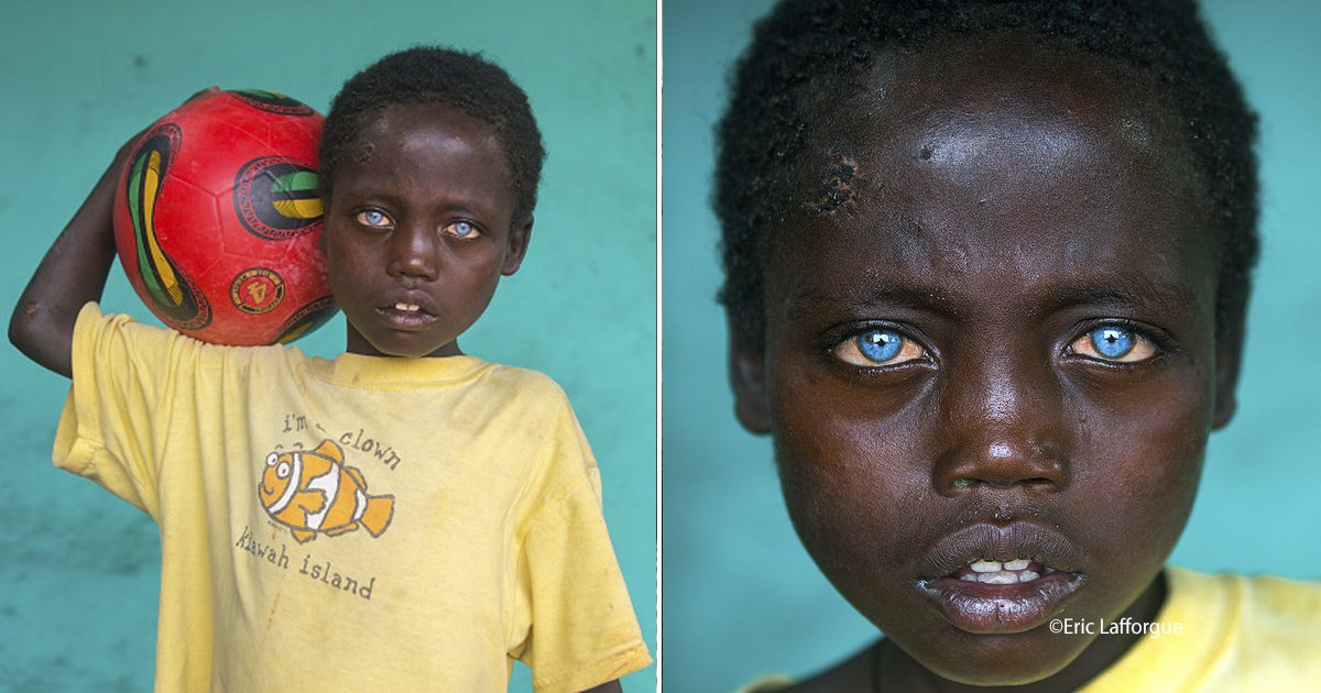cover22 4.jpg?resize=1200,630 - Este chico etíope ha impactado al mundo con sus extraordinarios ojos azules, debido a un síndrome extraño