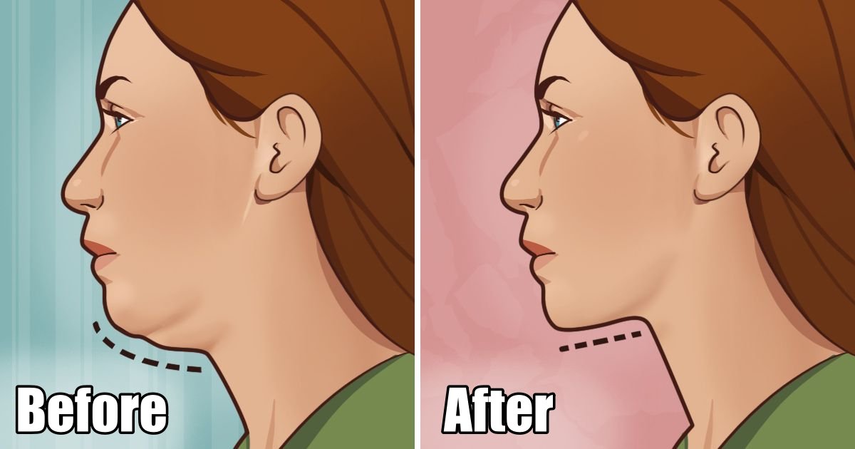 dc.jpg?resize=412,275 - 5 Simple Exercises That Will Help You To Get Rid Of Your 'Double Chin'