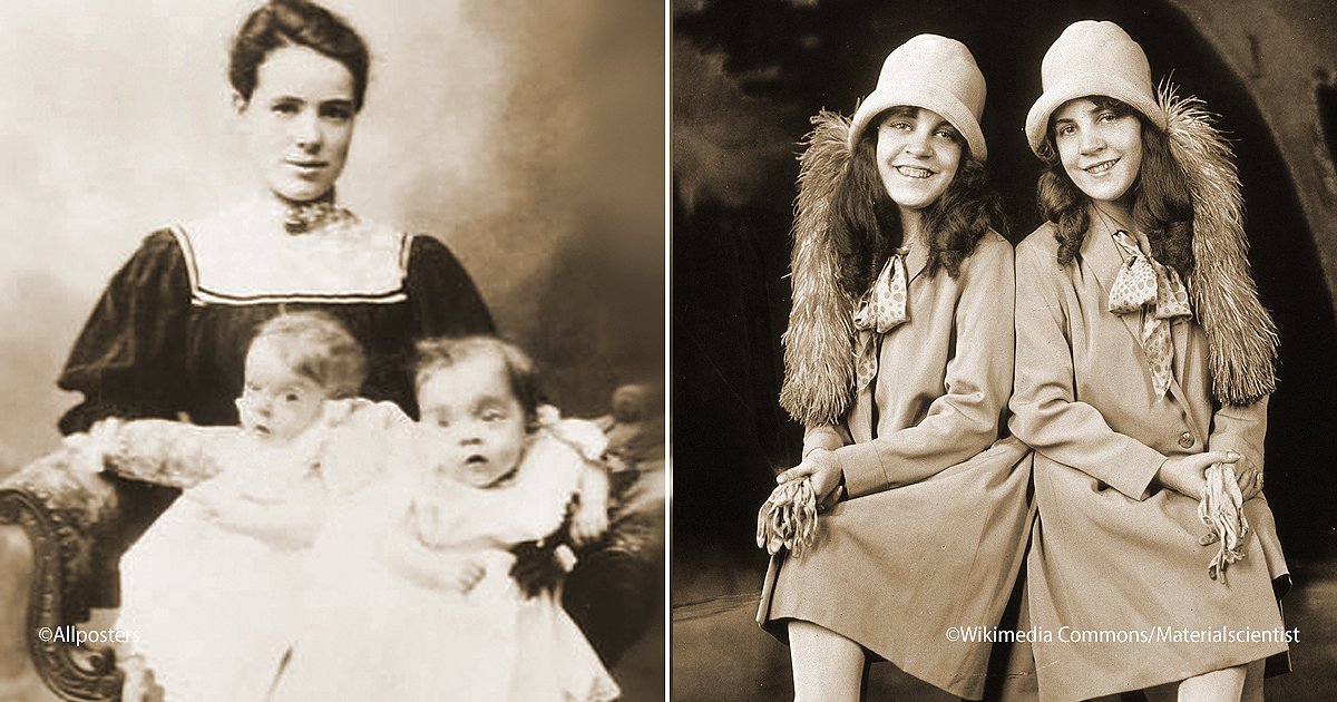 twins 2.jpg?resize=1200,630 - La trágica e impactante vida de las famosas gemelas siamesas Violet y Daisy Hilton