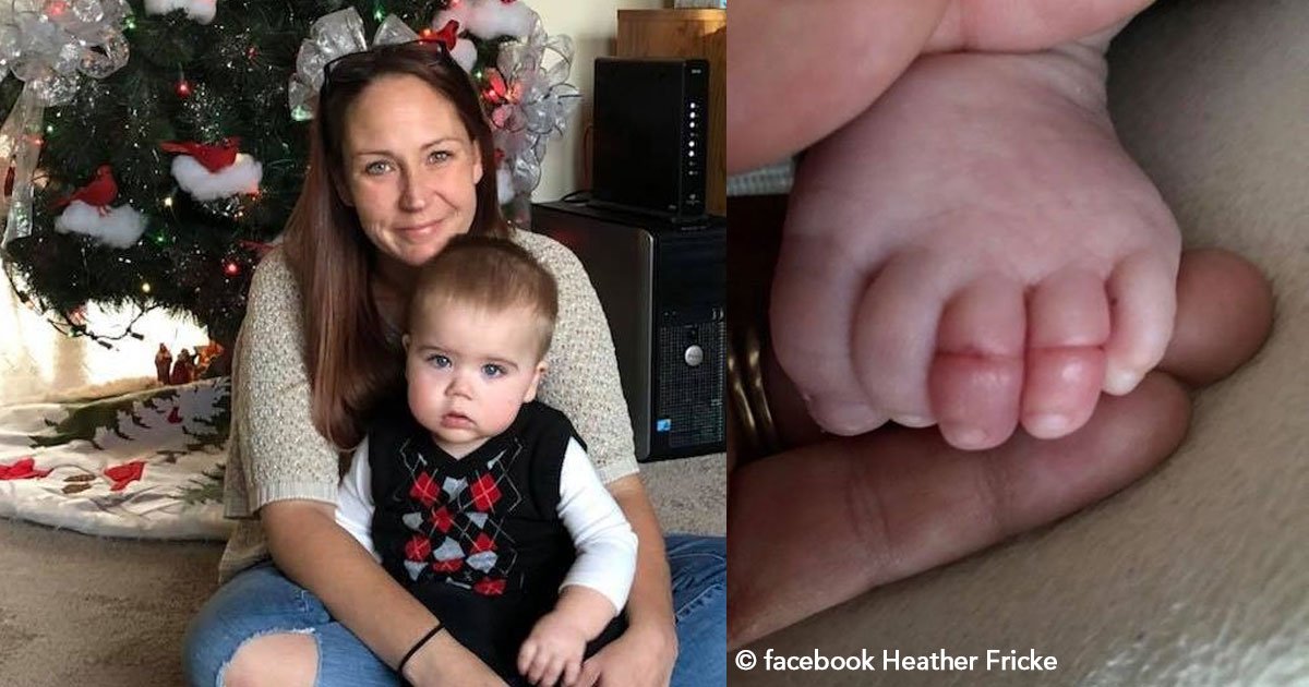 untitled 1 12.jpg?resize=1200,630 - Una madre advierte sobre el “síndrome del dedo gordo del pie” pues por poco amputan a su bebé por un descuido