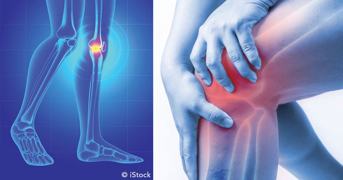 untitled 1 5.jpg?resize=412,232 - Principales causas y tratamientos efectivos para aliviar el dolor de rodillas a cualquier edad
